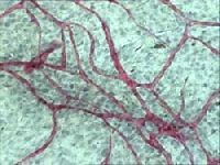 宣布推出用于高通量血管生成测定的angiookit®96