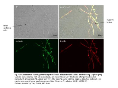 使用Clipmax感染白色念珠菌的肾上皮细胞的荧光染色
