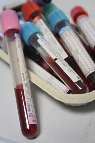 英国研究旨在制定新的NHS医疗保健指南