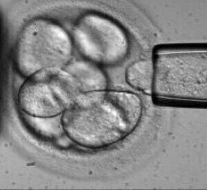 一个greement to Drive Development and Manufacturing of Cell Therapy Products