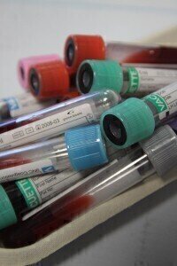 试验调查了在健康志愿者体内输入实验室培养的血细胞的影响